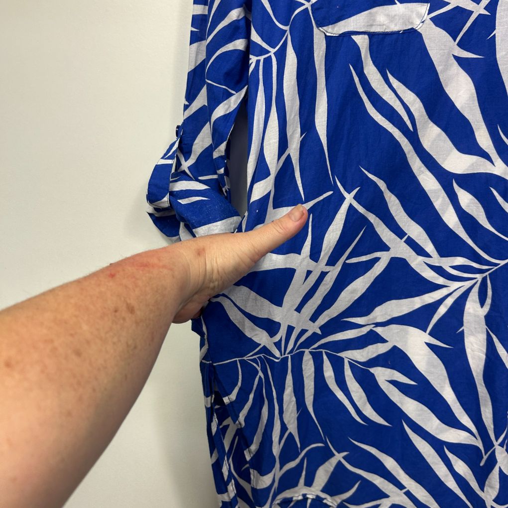 Blue and white floral print dress detail view